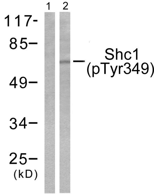 p66 / SHC Antibody (phospho-Tyr349)