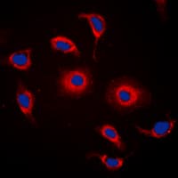 GPR119 Antibody (Internal)