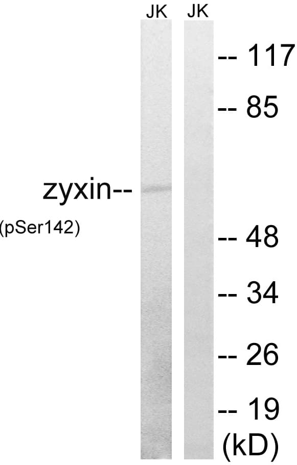 Zyxin Antibody (phospho-Ser142)
