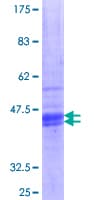 Human HRH1 / Histamine H1 Receptor Protein (Recombinant GST, N-terminus)
