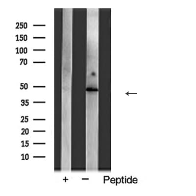 ACTA3 / ACTG2 Antibody