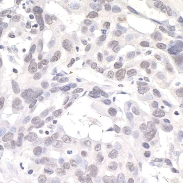 PNKP Antibody (aa100-150)