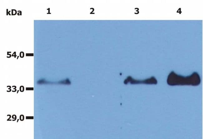 CD20 Antibody (clone MEM-97)