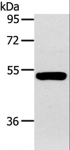 GJA9 / CX59 / Connexin 59 Antibody