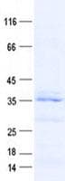 Human DEPDC4 Protein (Recombinant His, N-Terminal)