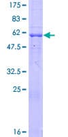 Human CMT2 / MAD2L1BP Protein (Recombinant GST)