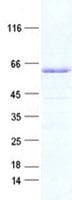 Human ETS2 Protein (Recombinant His, N-Terminal)
