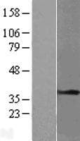 Human TPM1 / Tropomyosin Protein (Over-Expression Lysate Myc-DDK (Flag))