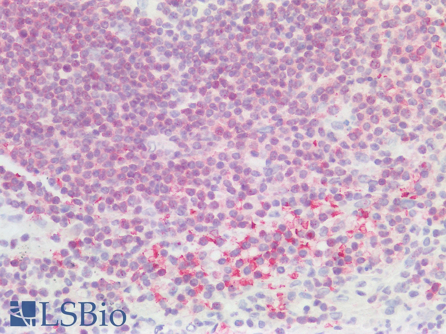 CD79B / CD79 Beta Antibody (Internal)