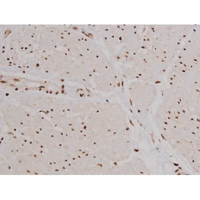 FAK / Focal Adhesion Kinase Antibody (phospho-Tyr397)
