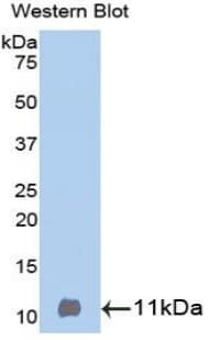 BTC / Betacellulin Antibody (aa32-111)