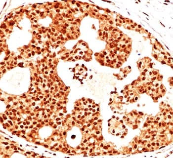 ESR2 / ER Beta Antibody (C-Terminus, clone ERb455, Ready-to-Use)