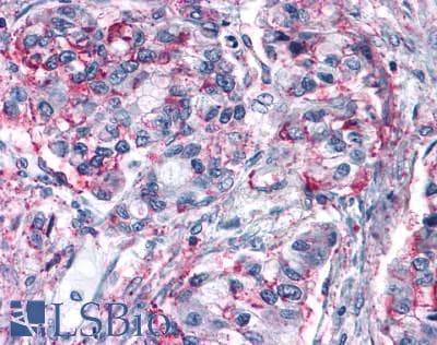 PathPlus™ GPRC6A Antibody (N-Terminus)