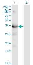 IHC-plus™ HSD3B1 Antibody (clone 3C11-D4)