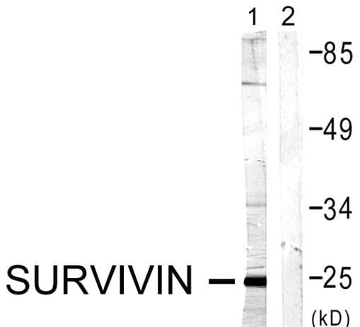 Polyclonal Rabbit anti-Human BIRC5 / Survivin Antibody (p117, IHC, IF, WB)