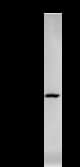 YARS / Tyrosyl-tRNA Synthetase Antibody (clone YAR5H08)