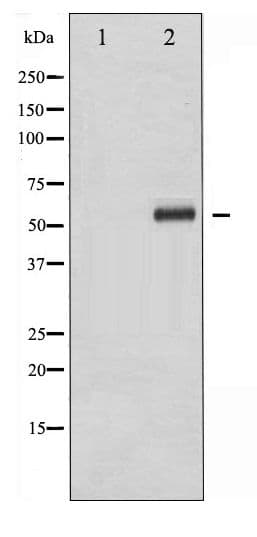ELK1 Antibody (phospho-Ser383)