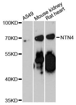 NTN4 / Netrin 4 Antibody