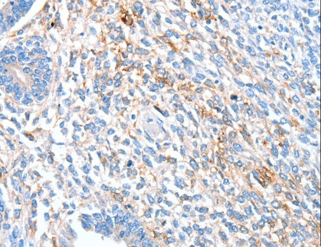 RALDH2 / ALDH1A2 Antibody