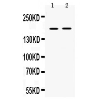 CP / Ceruloplasmin Antibody (aa20-258)