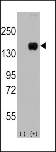 Polyclonal Rabbit anti-Human MAP3K5 / ASK1 Antibody (Ser966, WB)