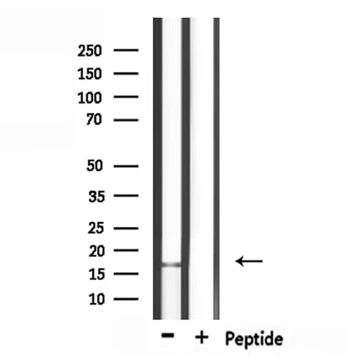 CALML3 Antibody