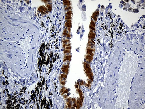 PRDX5 / Peroxiredoxin 5 Antibody (clone OTI3A1)