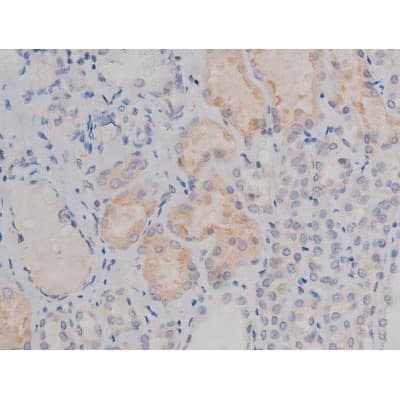 SYN / FYN Antibody (phospho-Tyr530)