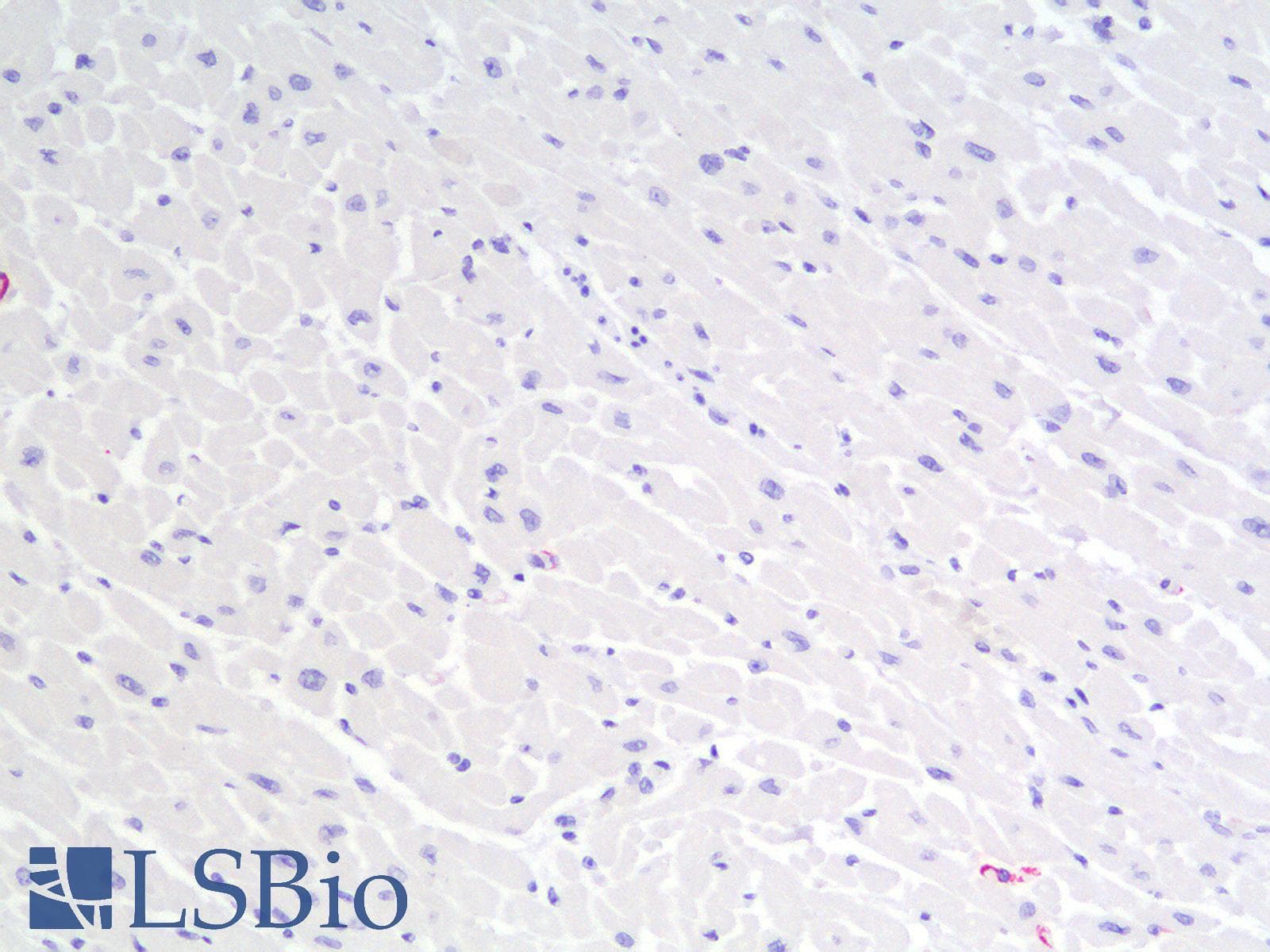 IHC-plus™ Recombinant Monoclonal Mouse anti-Human CALD1 / Caldesmon Antibody (clone rCALD1/820, IHC)