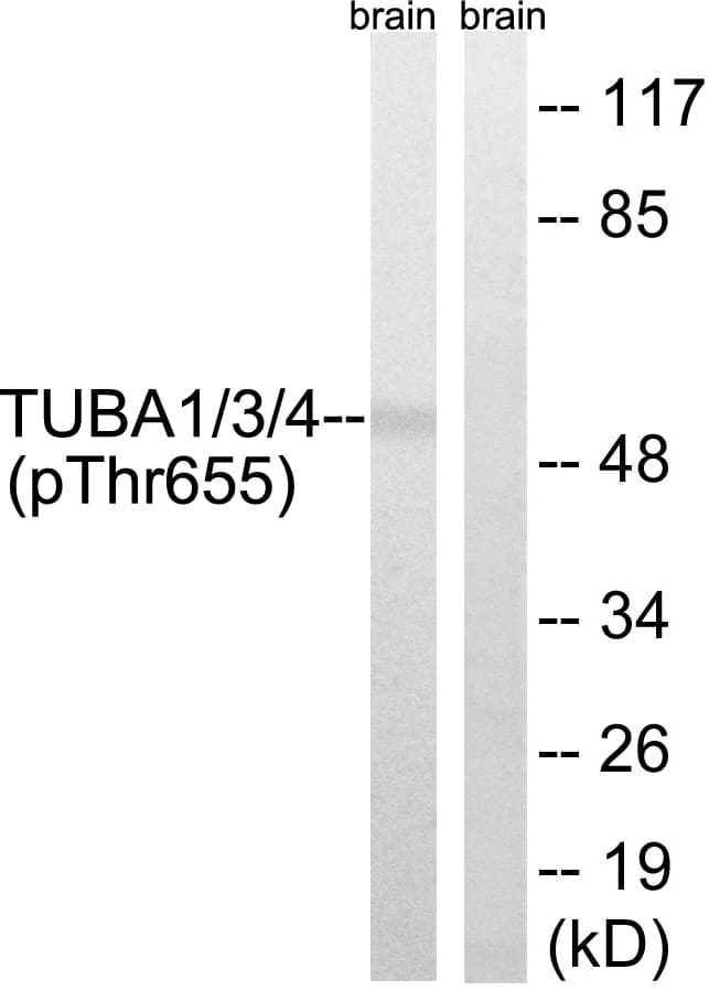 TUBA1+3+4 Antibody (phospho-Tyr272)