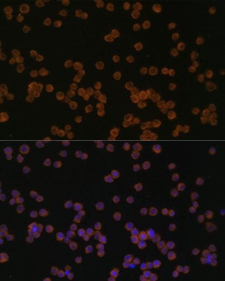 CHI3L1 / YKL-40 Antibody