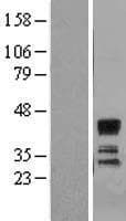 ST3GAL1 Protein (Over-Expression Lysate Myc-DDK (Flag))