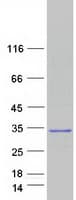 Human LIN7A Protein (Recombinant Myc-DDK (Flag))
