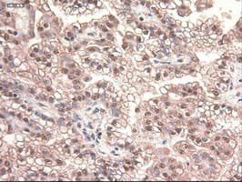 MYC / c-Myc Antibody (clone OTI3F2)