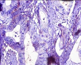 TTR / Transthyretin Antibody