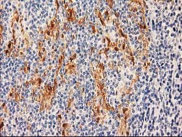 SULT1C2 / Sulfotransferase 1C2 Antibody (clone OTI8A1)
