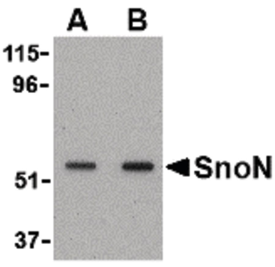 IHC-plus™ Polyclonal Rabbit anti-Human SKIL / SNO / SnoN Antibody (IHC, IF, WB)