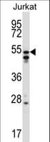 IHC-plus™ Polyclonal Rabbit anti-Human HNRNPH2 / hnRNP H2 Antibody (aa311-340, IHC, WB)