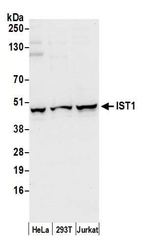 Polyclonal Rabbit anti-Human IST1 Antibody (aa300-350, WB)