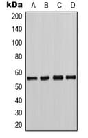 CHEK1 / CHK1 Antibody (phospho-Ser286)