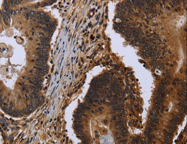 FHL3 Antibody