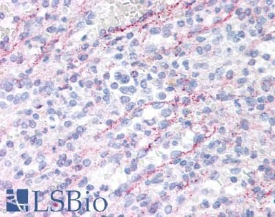 IHC-plus™ IL10RA Antibody (aa147-175)