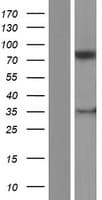 PLOD / PLOD1 Protein (Over-Expression Lysate Myc-DDK (Flag))