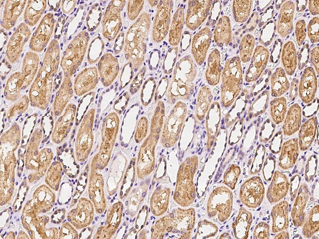 ATP12A Antibody