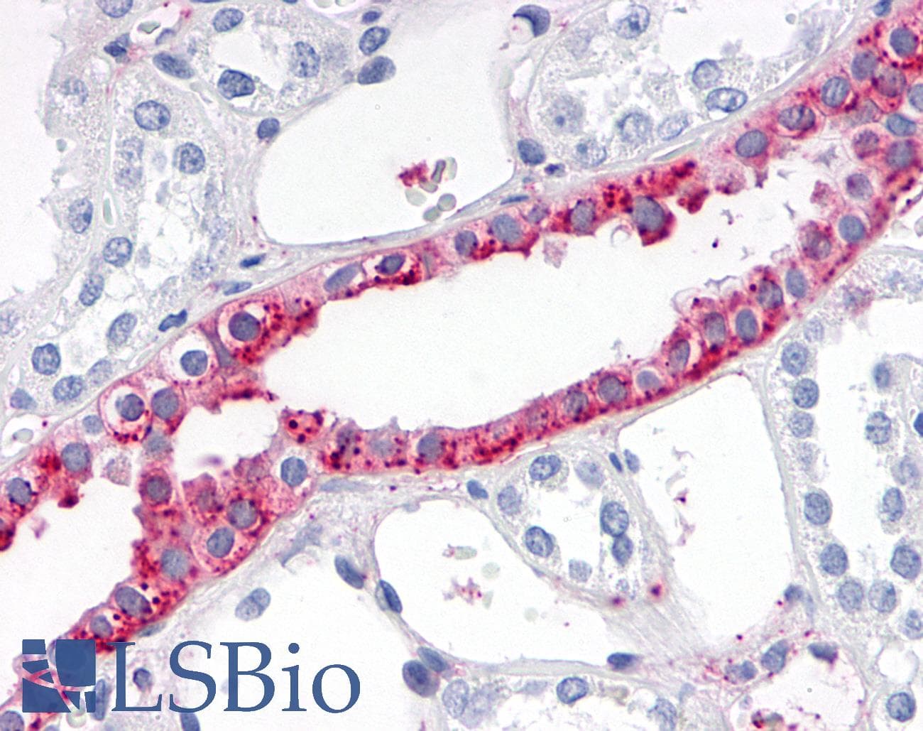 PathPlus™ Polyclonal Rabbit anti-Human ADAMTS4 Antibody (Disintegrin-like Domain, IHC)