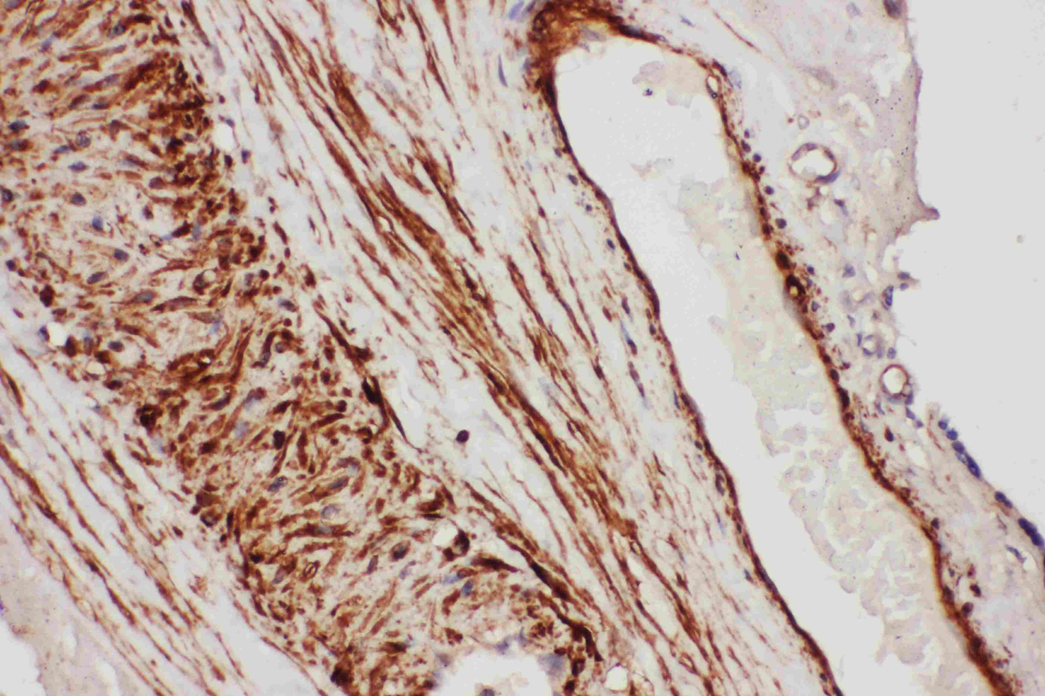 Polyclonal Rabbit anti-Human TFPI / LACI Antibody (aa261-280, IHC, WB)