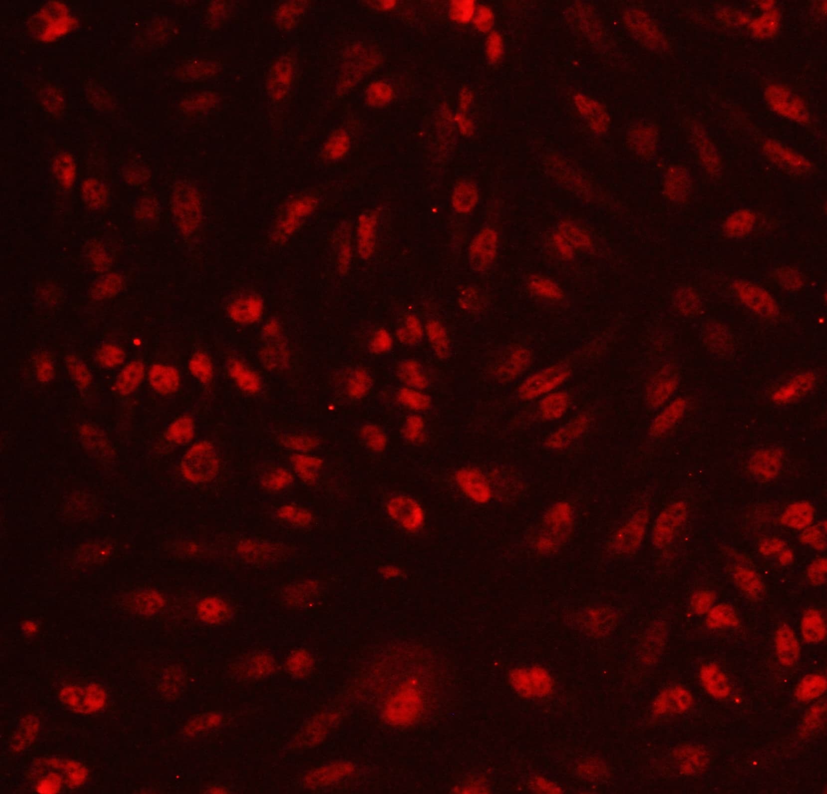 Polyclonal Rabbit anti-Human HDAC3 Antibody (aa1-18, IHC, WB)