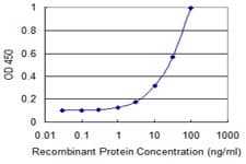 IHC-plus™ FH / Fumarase / MCL Antibody (clone 3E7)