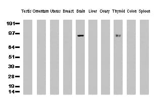 PECAM-1 / CD31 Antibody (clone UMAB30)