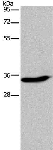 Polyclonal Rabbit anti-Human KLK6 / Kallikrein 6 Antibody (IHC, WB)